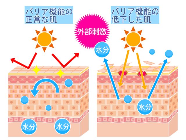 日焼けによるバリア機能の低下